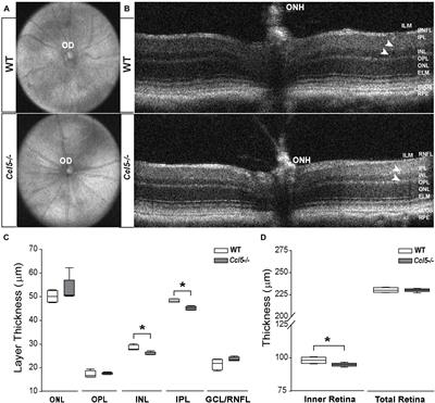 Ccl5 Mediates Proper Wiring of Feedforward and Lateral Inhibition Pathways in the Inner Retina